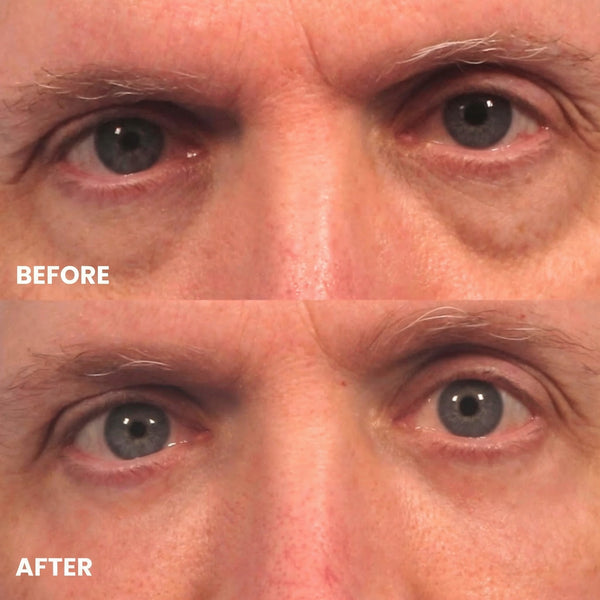 Chris H. | 66 years old