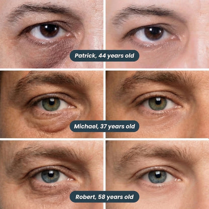 Next-Gen Under-Eye & Puffiness Patches